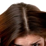 Treatment For Acne On The Scalp