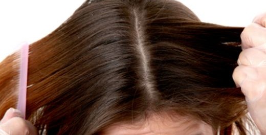 acne on the scalp