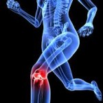 Joint Pain – Part 1