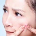 Acne Prevention – Part 1