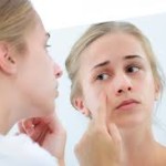 Acne Skin Care – Part 1