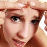 Acne Prevention – Part 2