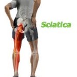 Sciatica – Part 3