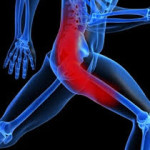 Sciatica – Part 2