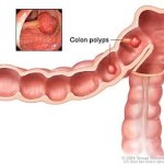 Diagnosis of Colorectal Disease