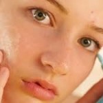 Acne Rosacea – Part 1